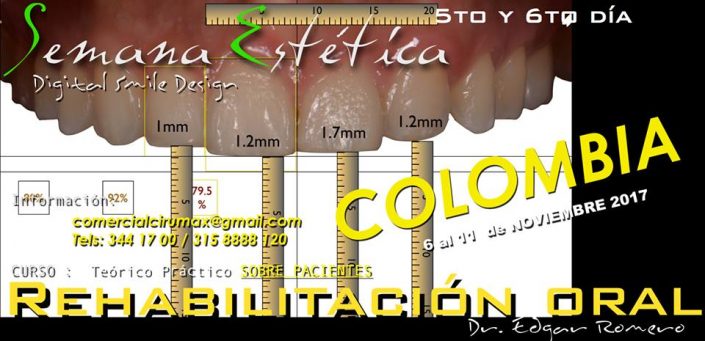 22528127_10154763417200064_56197367747104467_n