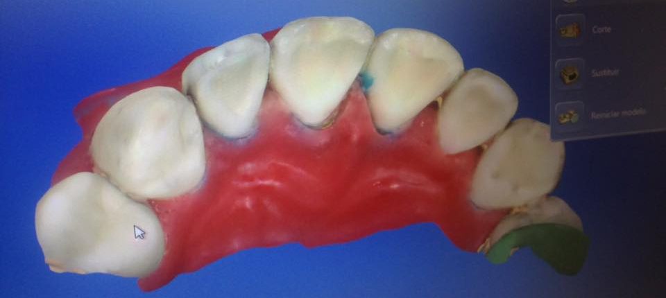 27857812_10155046935380064_5954712032787264355_n