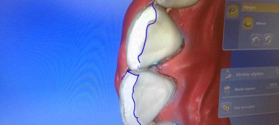 28059536_10155046935515064_83322044588093162_n
